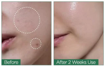 [Anua] Heartleaf 80% Moisture Soothing Ampoule | Hydrate & Calm Sensitive Skin